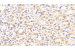 Detection of CIDEC in Rat Stomach Tissue using Polyclonal Antibody to Cell Death Inducing DFFA Like Effector C (CIDEC) (CIDEC antibody  (AA 1-221))