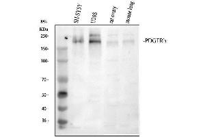 Western blot analysis of PDGFRB using anti-PDGFRB antibody (ABIN5693171).