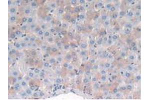 IHC-P analysis of Rat Liver Tissue, with DAB staining. (MME antibody  (AA 286-428))