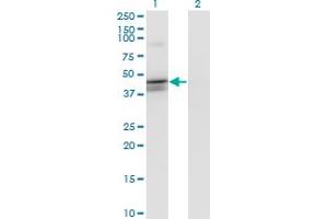 Western Blotting (WB) image for anti-Calcium Activated Nucleotidase 1 (CANT1) (AA 302-401) antibody (ABIN961190) (CANT1 antibody  (AA 302-401))