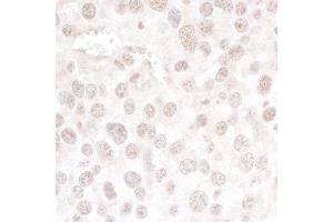 Immunohistochemistry (IHC) image for anti-hPrp3p (AA 100-150) antibody (ABIN7453461) (hPrp3p (AA 100-150) antibody)
