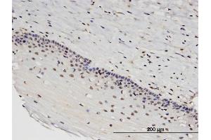 Immunoperoxidase of monoclonal antibody to RTKN2 on formalin-fixed paraffin-embedded human uterine cervix. (RTKN2 antibody  (AA 1-163))