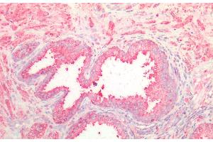 Detection of NOTCH2NL in Human Prostate Tissue using Polyclonal Antibody to Notch2 N-Terminal Like Protein (NOTCH2NL) (NOTCH2NL antibody  (AA 1-236))