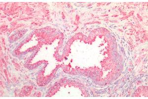 Detection of NOTCH2NL in Human Prostate Tissue using Polyclonal Antibody to Notch2 N-Terminal Like Protein (NOTCH2NL) (NOTCH2NL antibody  (AA 1-236))