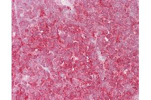 Anti-MCM6 antibody IHC of human thymus. (MCM6 antibody  (C-Term))