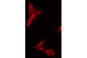ABIN6275571 staining HeLa by IF/ICC. (SIRPB1 antibody)