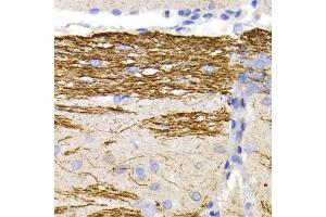 Immunohistochemistry of paraffin-embedded rat brain using NEFL antibody. (NEFL antibody)