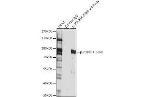 Immunoprecipitation analysis of 200 μg extracts of HeLa cells, using 3 μg Phospho-p90Rsk/RSK1/RPS6K-S380 pAb (ABIN6135275, ABIN6136172, ABIN6136173 and ABIN6225586). (RPS6KA1 antibody  (pSer380))