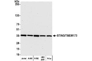 Western Blotting (WB) image for anti-Transmembrane Protein 173 (TMEM173) (AA 329-379) antibody (ABIN7449665) (STING/TMEM173 antibody  (AA 329-379))