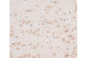 Immunohistochemistry of paraffin-embedded Rat brain using CDH18 Polyclonal Antibody at dilution of 1:100 (40x lens). (CDH18 antibody)