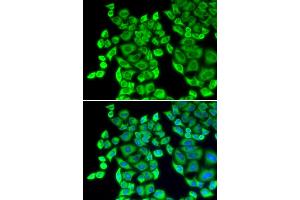 Immunofluorescence analysis of U2OS cells using EEF1D antibody (ABIN5971342). (EEF1D antibody)
