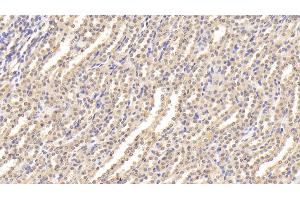 Detection of ESM1 in Rat Kidney Tissue using Polyclonal Antibody to Endothelial Cell Specific Molecule 1 (ESM1) (ESM1 antibody  (AA 22-184))