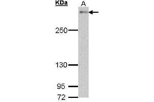 WB Image Sample (30 ug of whole cell lysate) A: Hela 5% SDS PAGE antibody diluted at 1:1000 (NOTCH2 antibody  (C-Term))