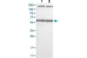 Western Blot analysis with KPNA6 polyclonal antibody  Lane 1: Human cell line RT-4 Lane 2: Human cell line U-251MG sp