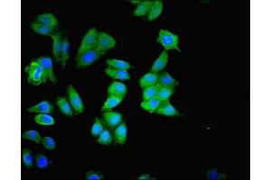 Immunofluorescence staining of HepG2 cells with ABIN7159999 at 1:200, counter-stained with DAPI. (ERK1 antibody  (AA 11-379))