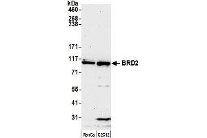 Western Blotting (WB) image for anti-Bromodomain Containing 2 (BRD2) (AA 675-725) antibody (ABIN7453879)