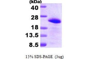 SDS-PAGE (SDS) image for Brain and Acute Leukemia, Cytoplasmic (BAALC) (AA 1-145) protein (His tag) (ABIN668049) (BAALC Protein (AA 1-145) (His tag))