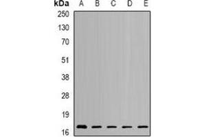 Western blot analysis of NUDT2 expression in SKOV3 (A), HL60 (B), mouse kidney (C), mouse brain (D), rat heart (E) whole cell lysates. (NUDT2 antibody)
