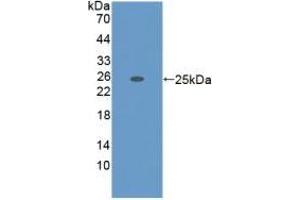 ADAMTS7 antibody  (AA 226-437)