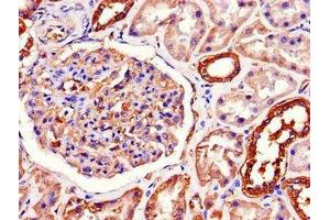 Immunohistochemistry of paraffin-embedded human kidney tissue using ABIN7170036 at dilution of 1:100 (ATP1A1 antibody  (AA 225-407))