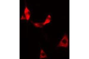 ABIN6269375 staining HeLa cells by IF/ICC. (DPYSL2 antibody  (C-Term))