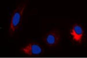 Immunofluorescent analysis of TAU (pS356) staining in Hela cells.