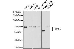 Western blot analysis of extracts of various cell lines, using WASL antibody (ABIN1875345) at 1:3000 dilution. (Neural Wiskott-Aldrich syndrome protein (WASL) antibody)