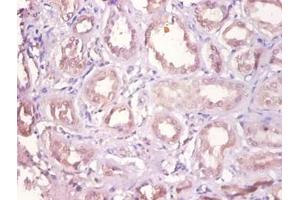 Immunohistochemistry of paraffin-embedded human kidney using DHRS9 antibody at dilution of 1:100. (DHRS9 antibody  (FITC))