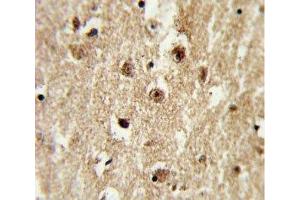 IHC analysis of FFPE human brain tissue with IGFBP2 antibody (IGFBP2 antibody  (AA 277-305))