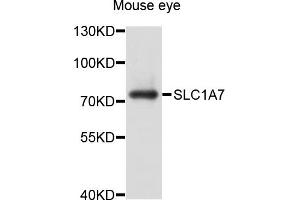 Western blot analysis of extracts of mouse eye, using SLC1A7 antibody (ABIN5998834) at 1/1000 dilution.