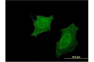 Immunofluorescence of monoclonal antibody to CNP on HeLa cell. (Cnpase antibody  (AA 1-421))