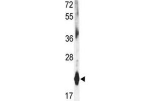 Western blot analysis of DHFR antibody and mouse liver tissue lysate (Dihydrofolate Reductase antibody  (AA 135-164))