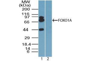 Image no. 1 for anti-Forkhead Box O1 (FOXO1) (AA 250-300) antibody (ABIN960178) (FOXO1 antibody  (AA 250-300))