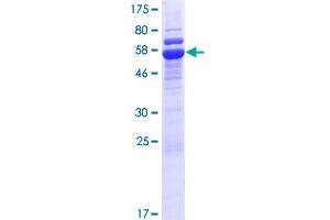 STUB1 Protein (AA 1-303) (GST tag)