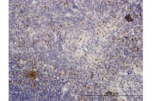 Immunostaining (ISt) image for anti-Minichromosome Maintenance Deficient 4 (MCM4) (AA 1-863) antibody (ABIN517777)