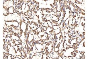 IHC analysis of BHMT using anti-BHMT antibody (ABIN7599940). (BHMT antibody  (AA 13-386))