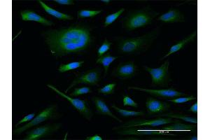 Immunofluorescence of monoclonal antibody to IL13 on HeLa cell. (IL-13 antibody)