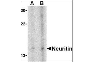 Western blot analysis of neuritin in Daudi cell lysate with this product at (A) 5 and (B) 10 μg/ml. (NRN1 antibody  (Center))