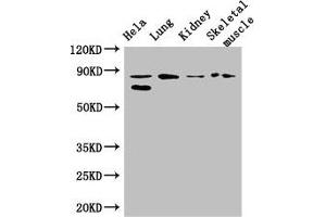 Western Blot Positive WB detected in: Hela whole cell lysate, Mouse lung tissue, Mouse kidney tissue, Mouse skeletal muscle tissue All lanes: PRDM4 antibody at 3. (PRDM4 antibody  (AA 301-500))