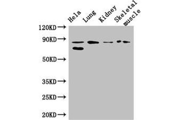 PRDM4 anticorps  (AA 301-500)