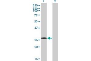 Western Blot analysis of LRRK1 expression in transfected 293T cell line by LRRK1 MaxPab polyclonal antibody. (LRRK1 antibody  (AA 1-261))