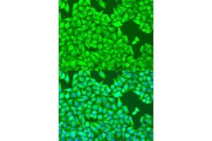 Immunofluorescence analysis of U2OS cells using TUBB8 antibody. (Tubulin, beta 8 antibody)