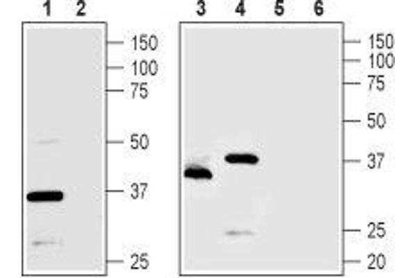 TMEM66 antibody  (Intracellular, Lumenal Region)