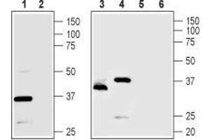Western blot analysis of rat pancreas (lanes 1 and 2), Mouse MS1 endothelial cells (lanes 3 and 5) and human PANC1 pancreatic carcinoma cells (lanes 4 and 6) lysates: - 1,3,4. (TMEM66 antibody  (Intracellular, Lumenal Region))