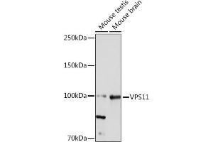 Western blot analysis of extracts of various cell lines, using VPS11 Rabbit mAb (ABIN7271272) at 1:1000 dilution. (VPS11 antibody)