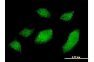 Immunofluorescence of monoclonal antibody to UBQLN1 on HeLa cell. (Ubiquilin 1 antibody  (AA 1-589))