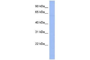 WB Suggested Anti-DTX1 Antibody Titration:  0. (Deltex Homolog 1 antibody  (N-Term))