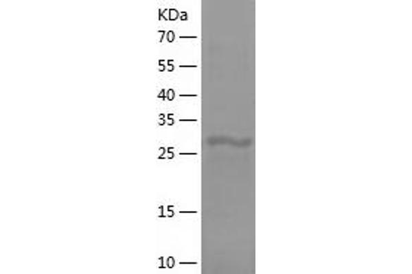 C4B Protein (AA 1454-1744) (His tag)