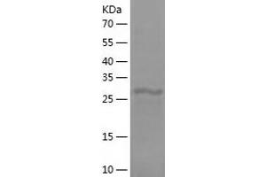 Western Blotting (WB) image for Complement Component C4b (C4b) (AA 1454-1744) protein (His tag) (ABIN7285221) (C4B Protein (AA 1454-1744) (His tag))