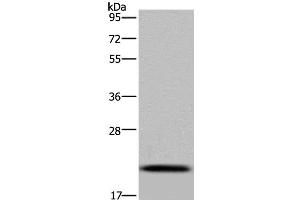 Western Blot analysis of Raji cell using NDUFAF4 Polyclonal Antibody at dilution of 1:300 (NDUFAF4 antibody)